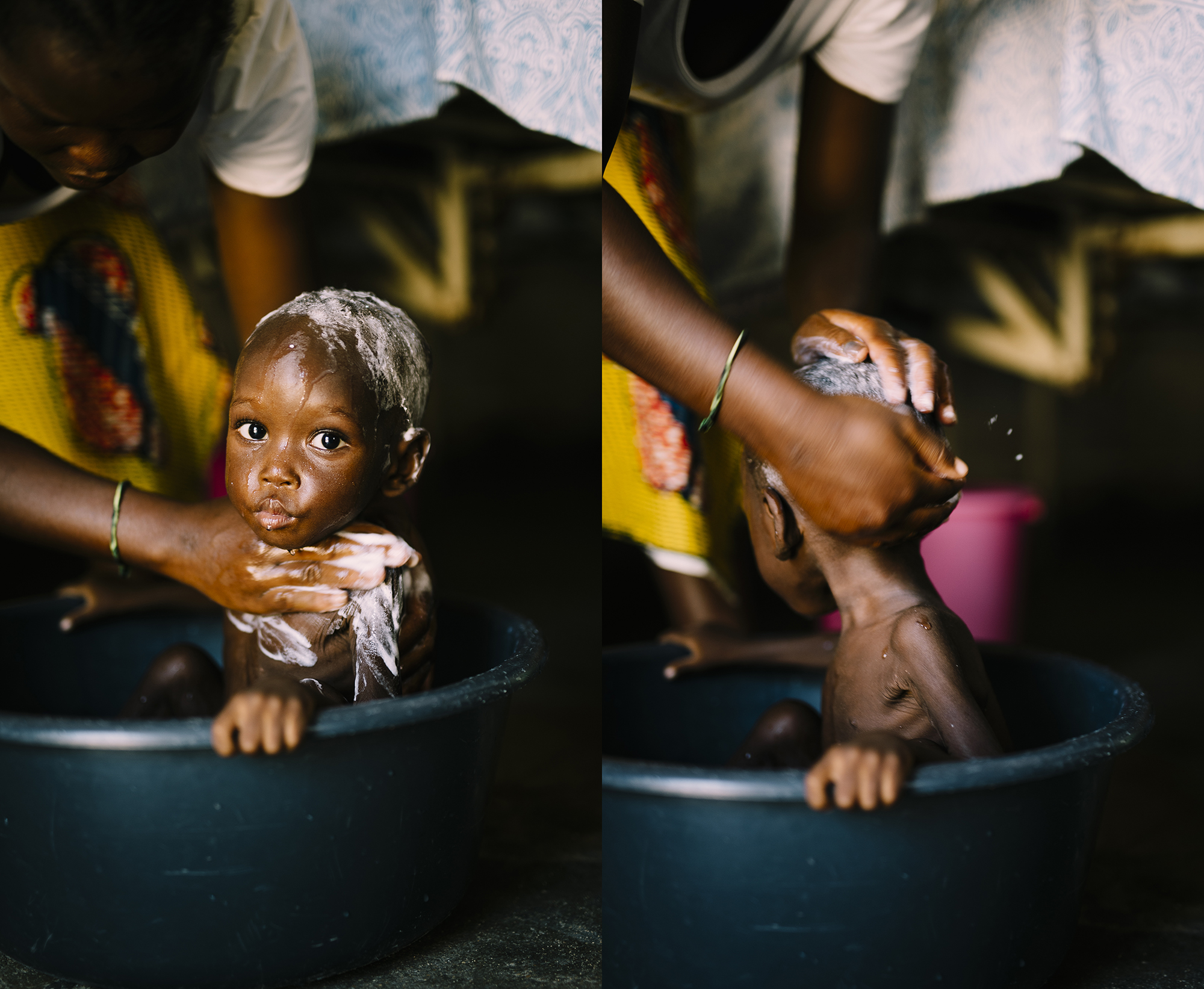 Child receiving a bath in a basin, mother gently washing with soap, nurturing care in a malnutrition clinic setting, highlighting the emotional support and healing process for mothers and infants.