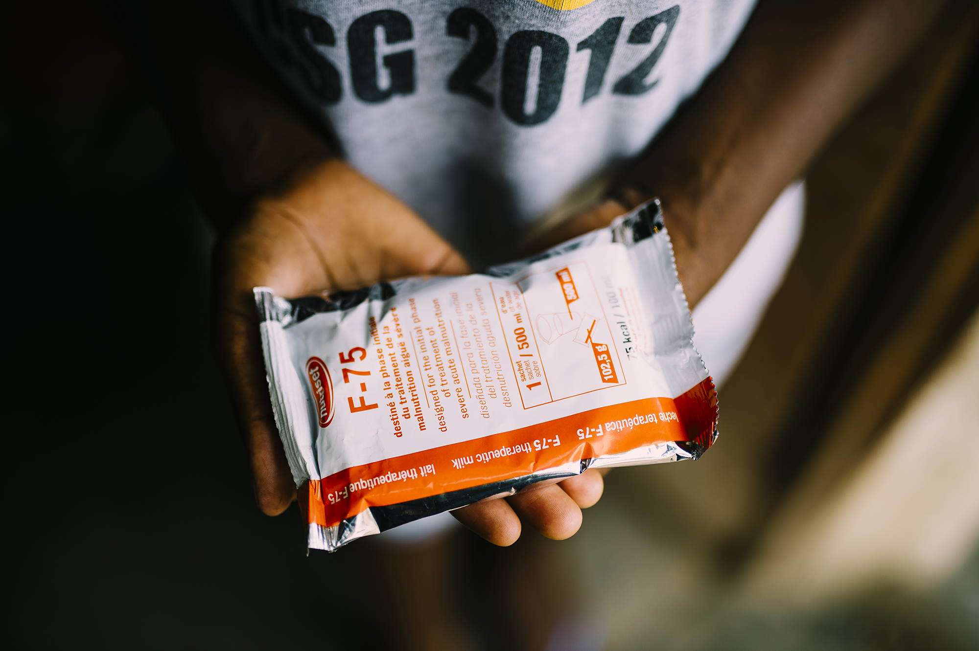 Therapeutic milk packet labeled "F-75" held in hands, used for treating malnutrition in infants at Saving Moses clinics in Angola.