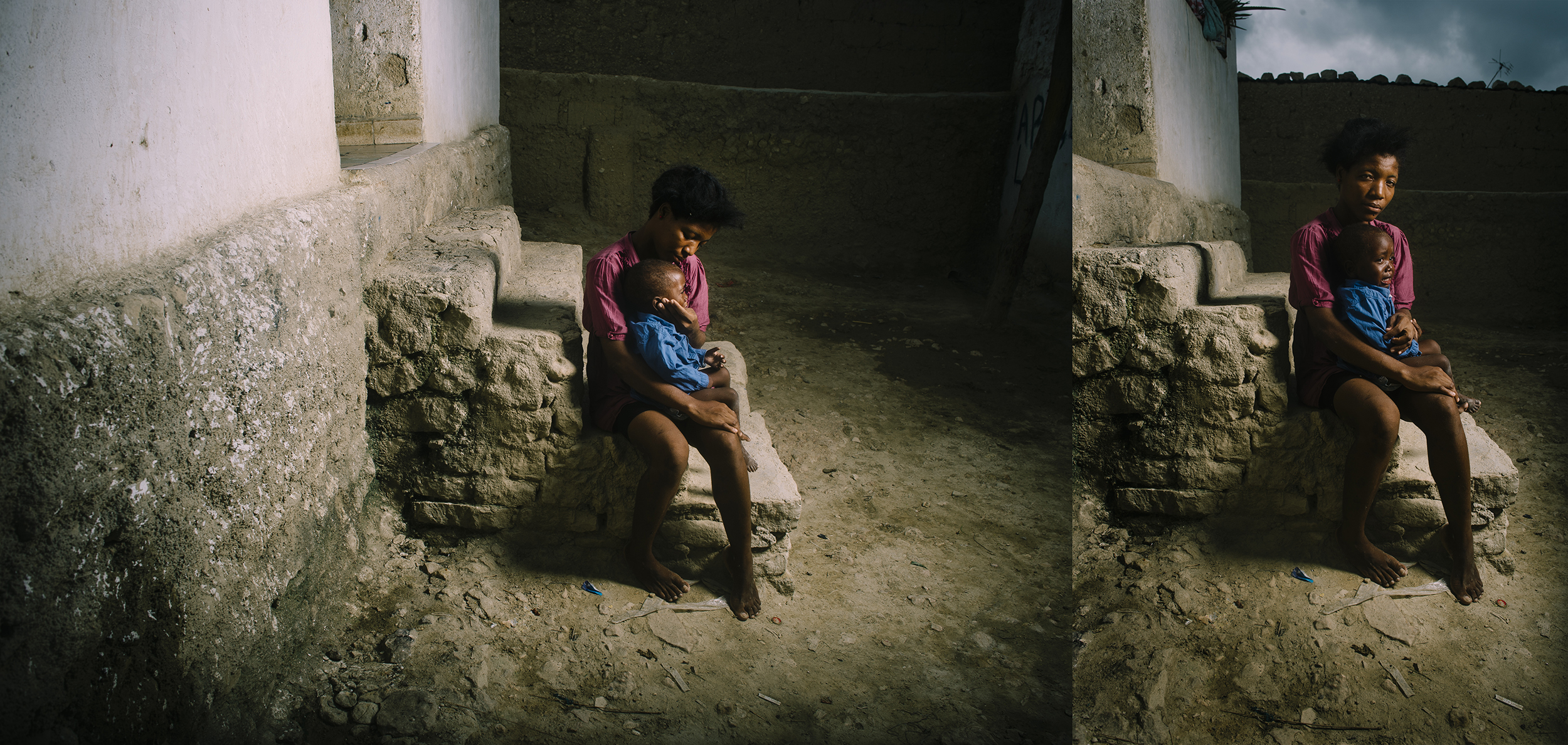 Mother holding malnourished child in malnutrition clinic, emotional support and care, community healing journey, therapeutic environment.