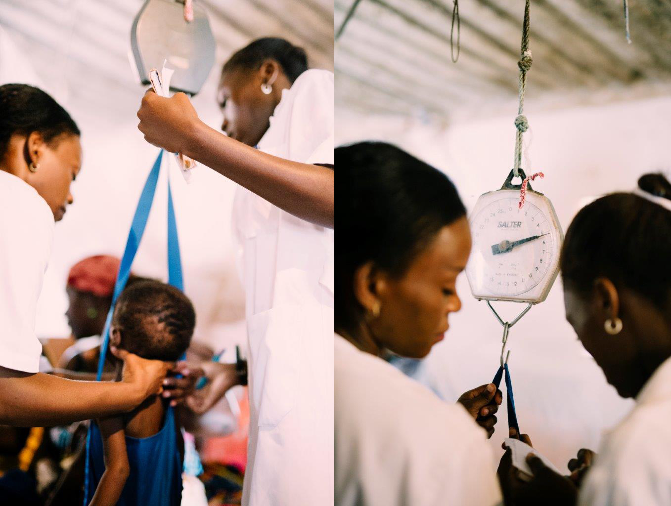 Two healthcare workers weighing a malnourished child using a hanging scale in a malnutrition clinic in Angola, emphasizing individualized care and assessment of severe malnutrition.