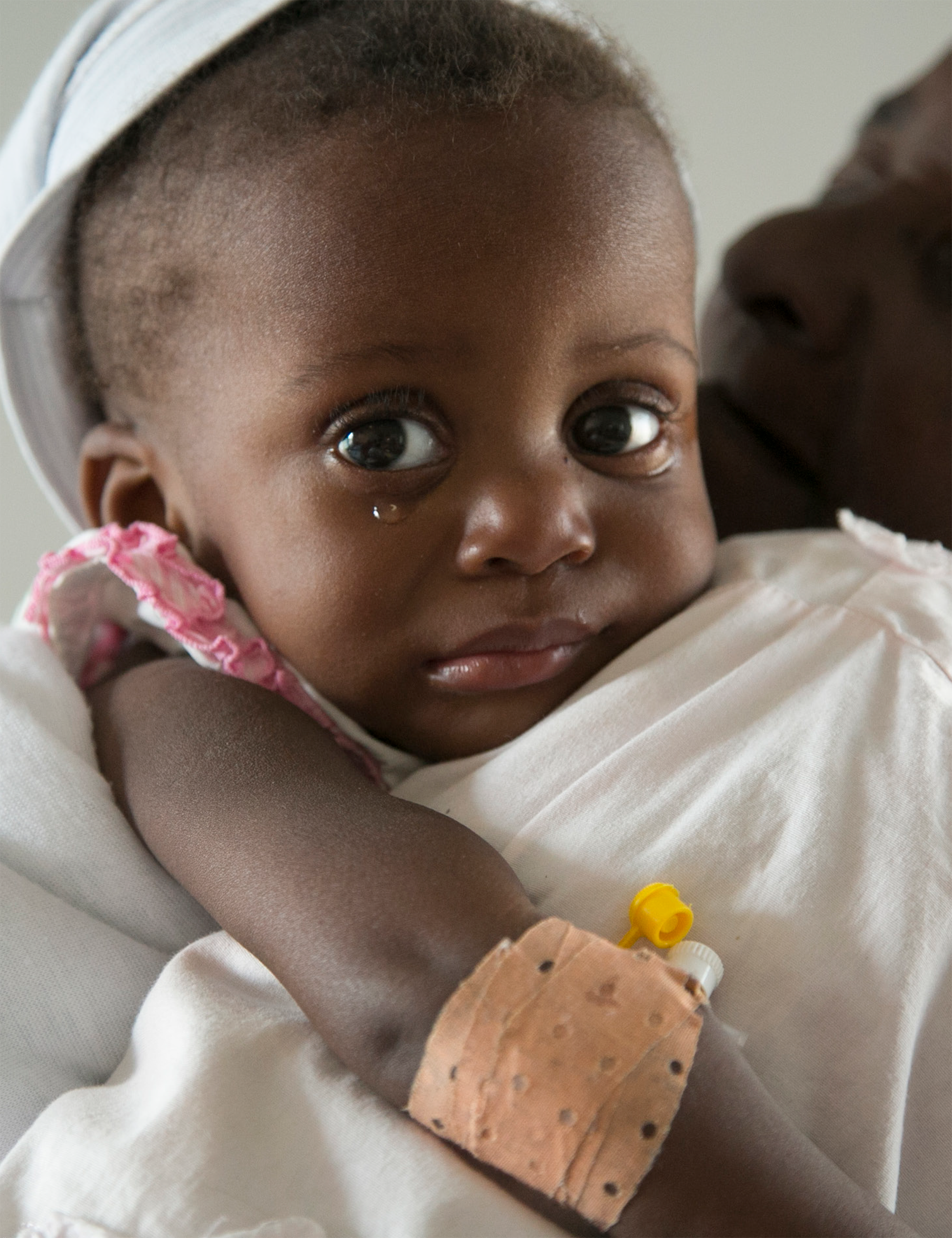 Child with tearful expression, wearing a pink-trimmed white garment, receiving care, highlighting vulnerability and the impact of malnutrition, relevant to Saving Moses' mission in the 2017 annual report.