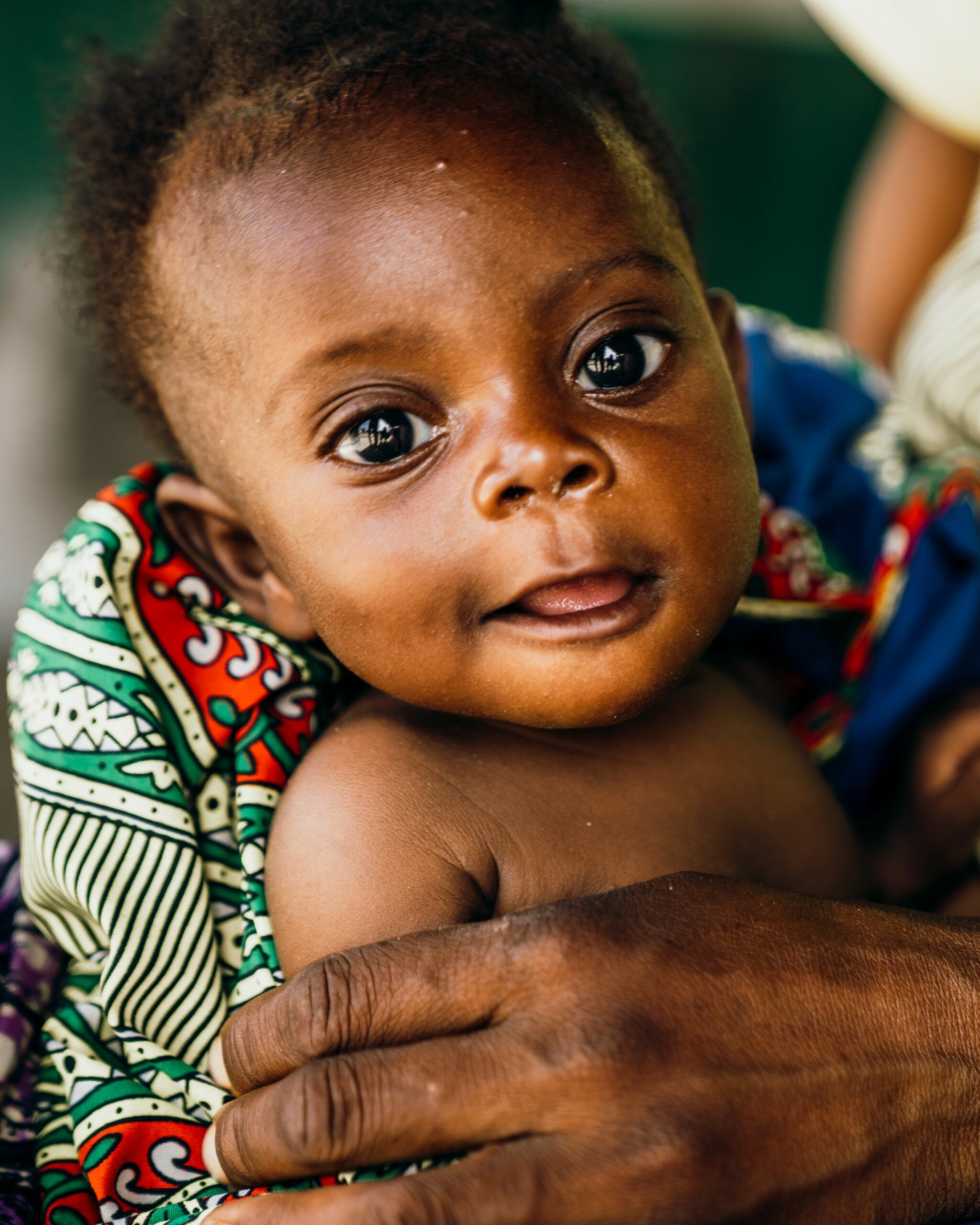 baby no longer suffering from severe acute malnutrition thanks to saving moses