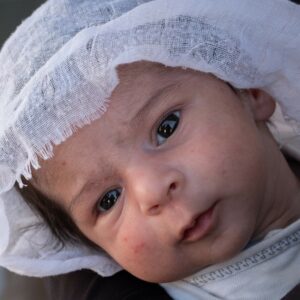 Baby with a white headscarf, gazing directly at the camera, representing vulnerable infants supported by Saving Moses' lifesaving programs.