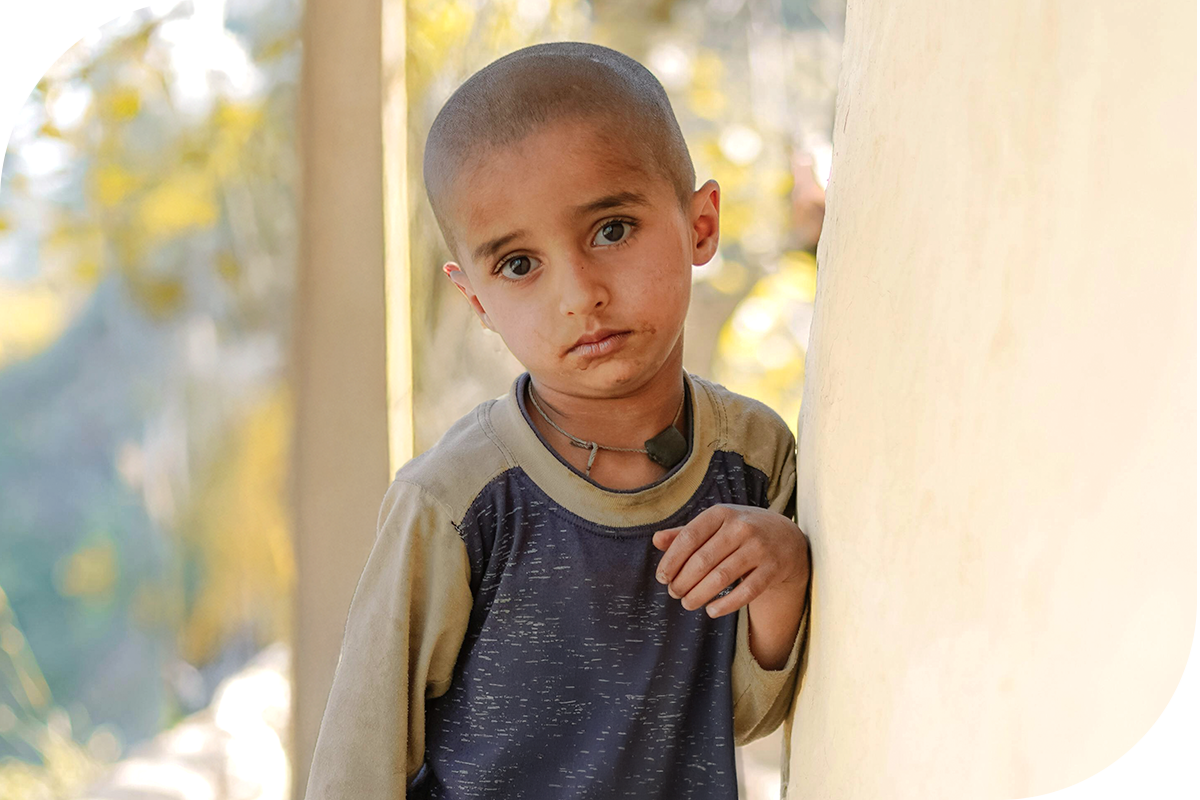 Child with shaved head and worn clothing, looking sadly at the camera, representing the plight of Syrian babies affected by war and starvation.